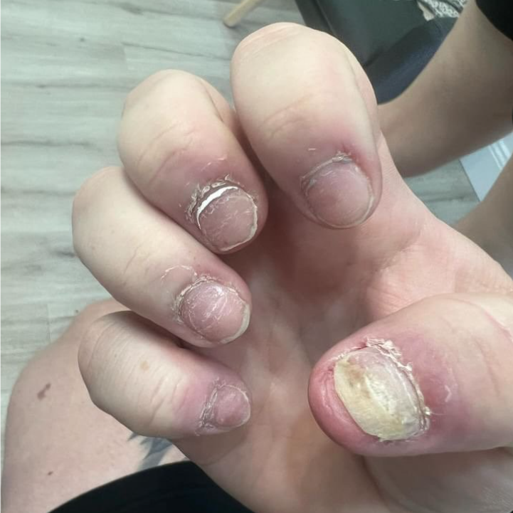 Nailed It: A Journey of Self-Care, Perseverance, and Transformation