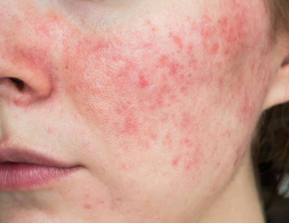 What Your Skin’s Telling You This Winter