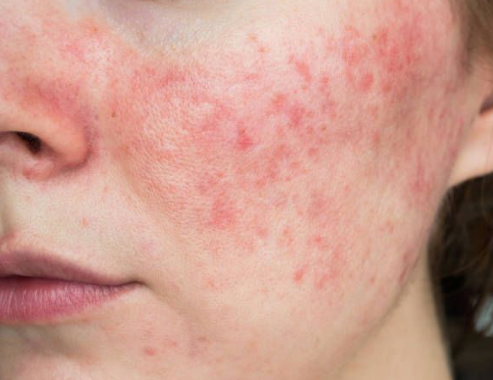 What Your Skin’s Telling You This Winter